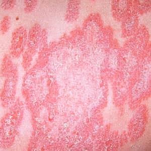 webpathology skin.